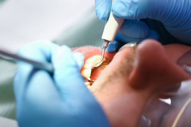 Best Emergency Root Canal Treatment in Howe, TX