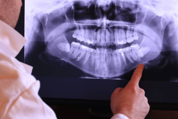 Best Walk-In Emergency Dentist in Howe, TX